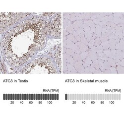 ATG3/APG3 Antibody, Novus Biologicals 25 &mu;L, Unlabeled:Antibodies, Polyclonal